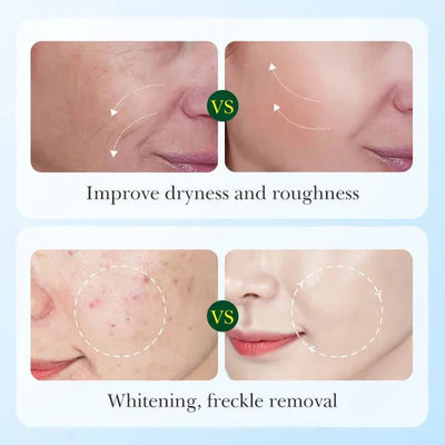 Sadoer - Licorice Root Whitening Skin Care Set